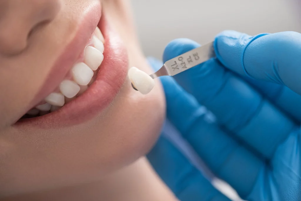 patient getting veneers for their smile makeover
