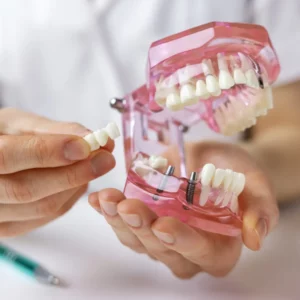 dentist in Garland, TX, demonstrating how dental bridges work