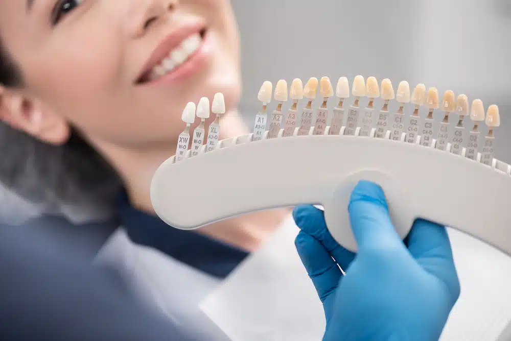 A patient choosing their porcelain veneer shade